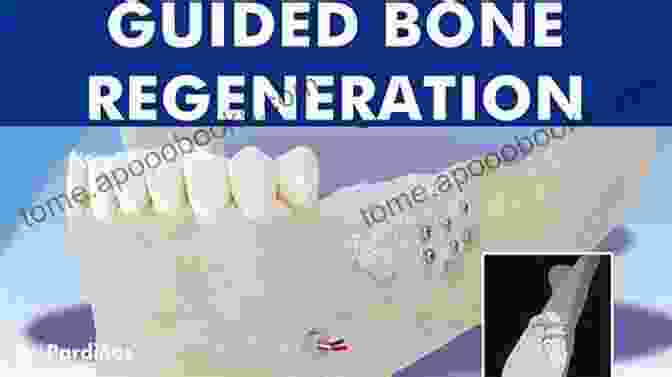 Bone Management Book Cover | Comprehensive Guide To Bone Regeneration For Dental Implants Bone Management In Dental Implantology