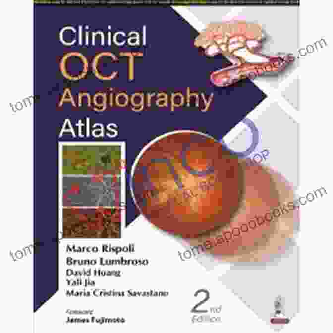 Clinical OCT Angiography Atlas By Anthony Gibson Clinical OCT Angiography Atlas Anthony Gibson