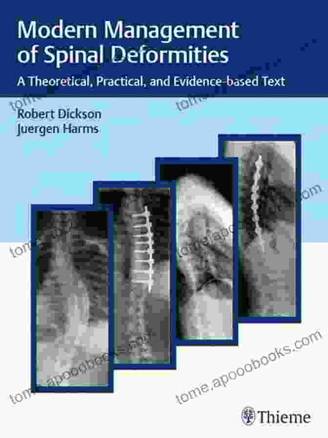 Modern Management Of Spinal Deformities Book Cover Modern Management Of Spinal Deformities: A Theoretical Practical And Evidence Based Text