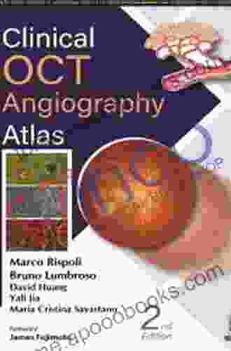 Clinical OCT Angiography Atlas Anthony Gibson