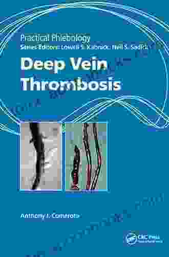 Practical Phlebology: Deep Vein Thrombosis